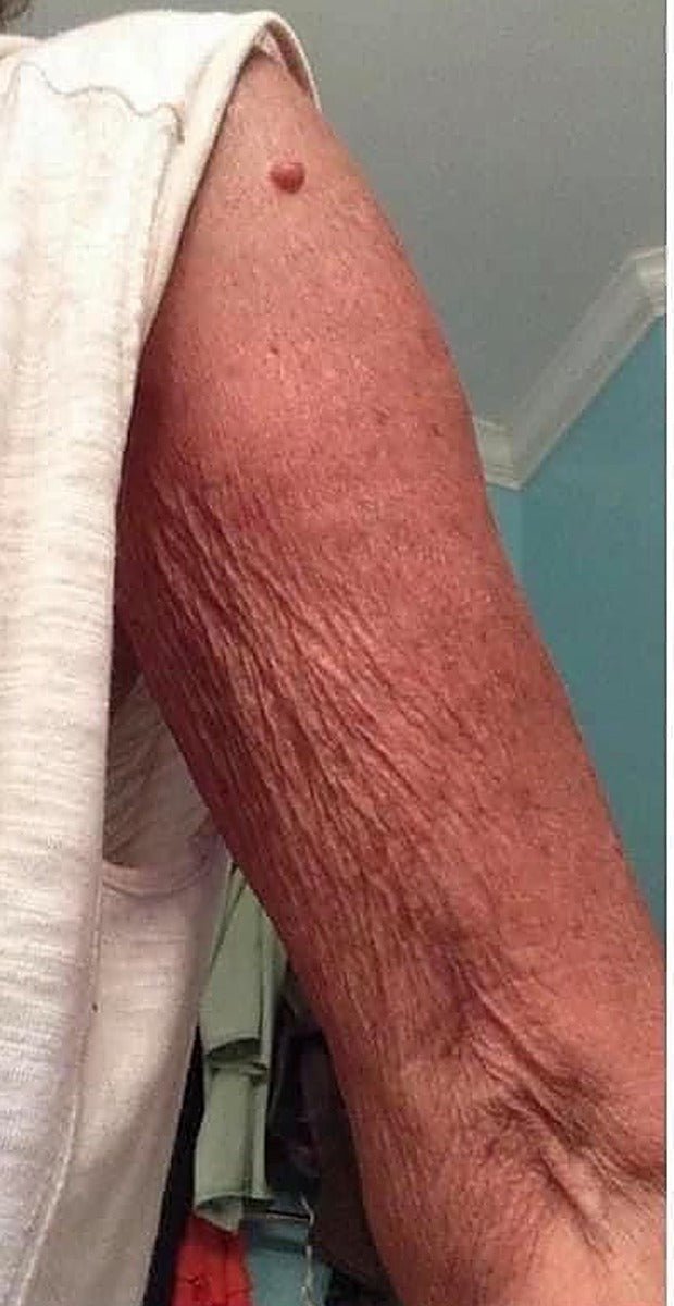 The at-home habit women over 40 are using for crepey-looking arms
